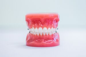 orthodontics jacksonville